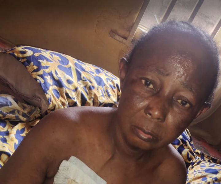 Mother Of Five Seeks N3.5m For Kidney Surgery